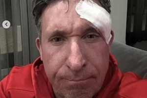 邮报：50岁利物浦名宿罗比·福勒已接受面部肿瘤切除手术