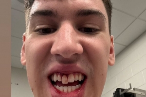 门牙献祭了？拉拉维亚晒自拍：为这次客场之旅画上圆满句号